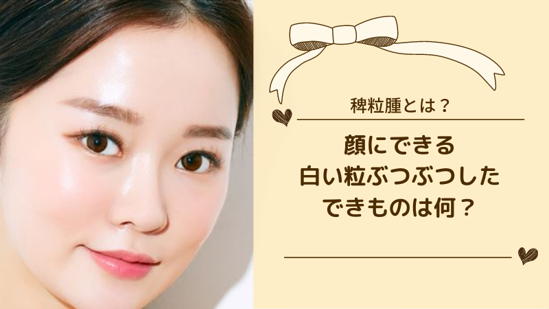 顔にできる白い粒ぶつぶつしたできものは何 目の周りや頬にできちゃったときのケアとは ハッピーマニア